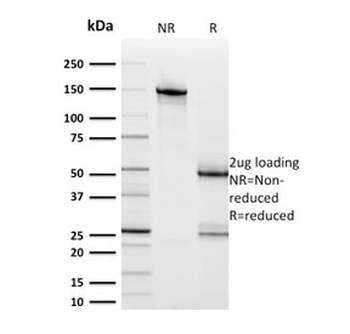 HER2 Antibody / ErbB2