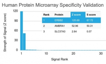 HER2 Antibody / ErbB2