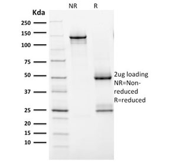 HER2 Antibody / ErbB2