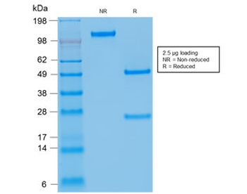 Kappa Light Chain Antibody