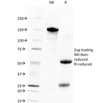 TROP2 Antibody