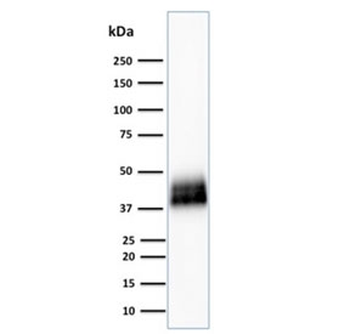 TROP2 Antibody