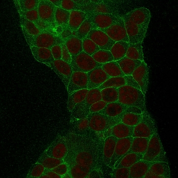 TROP2 Antibody