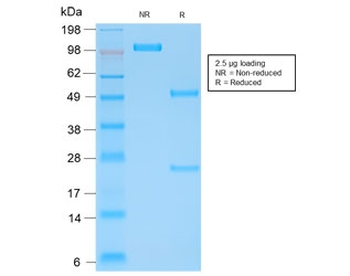 Kappa Light Chain Antibody