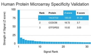 TROP2 Antibody