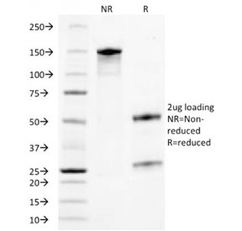 TROP2 Antibody