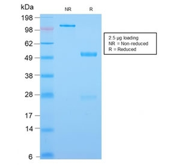 CDX2 Antibody