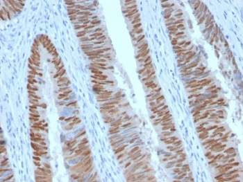 CDX2 Antibody