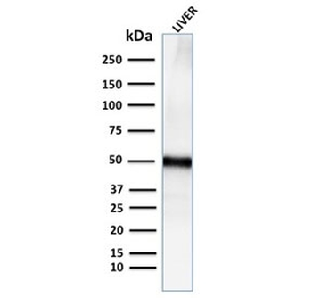 Adipophilin Antibody / Perilipin 2 / ADRP / PLIN2