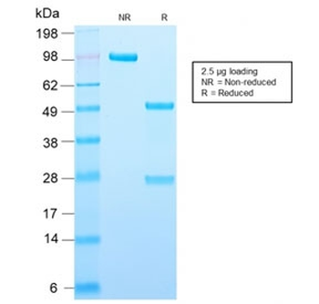 Adipophilin Antibody / Perilipin 2 / ADRP / PLIN2