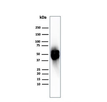 Thymidine Phosphorylase Antibody / PD-ECGF