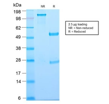 Thymidine Phosphorylase Antibody / PD-ECGF