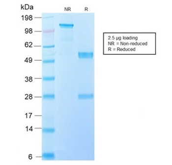 EGF Receptor / EGFRvIII Antibody