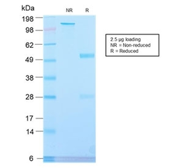 Placental Alkaline Phosphatase Antibody / ALPP