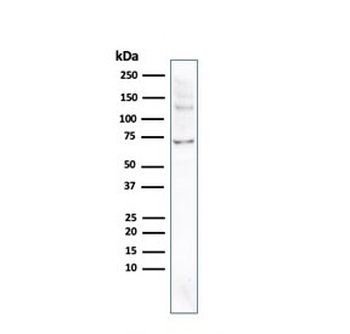 Placental Alkaline Phosphatase Antibody / ALPP