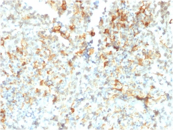 FCGRT Antibody / FcRn