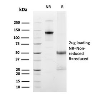 FCGRT Antibody / FcRn