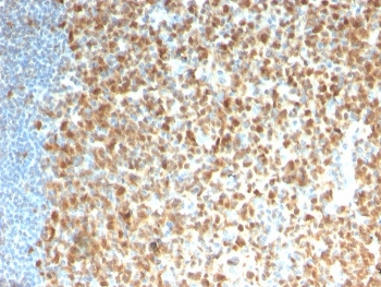 Recombinant MCM7 Antibody