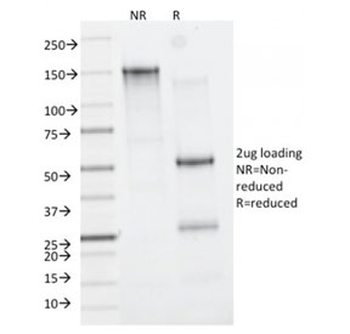 CD163 Antibody