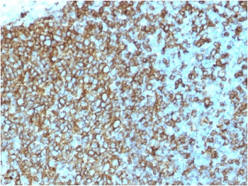 Recombinant Pan-HLA Antibody (DP/DQ/DR)