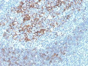 Recombinant CD23 Antibody