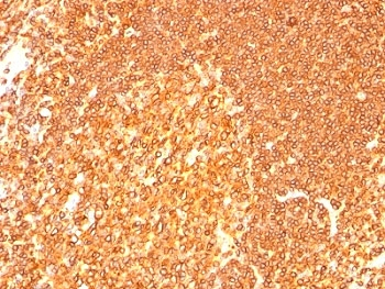 HLA-DRB1 Antibody Cocktail (MHC II)