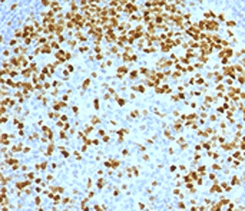 Topoisomerase II alpha Antibody / TOP2A