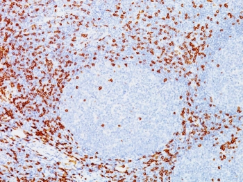 CD8A Antibody
