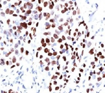 p21 Antibody / CDKN1A