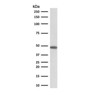 KRT19 Antibody / Cytokeratin 19