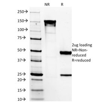 DOG1 Antibody / TMEM16A / ANO1