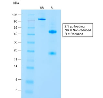 CD8A Antibody