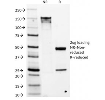 DOG1 Antibody / TMEM16A / ANO1
