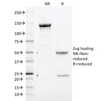 Transferrin Receptor Antibody / TFRC / CD71