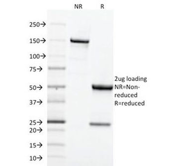 Transferrin Receptor Antibody / TFRC / CD71