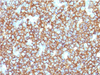 CD20 Antibody