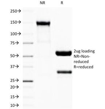 IgG Heavy Chain Antibody