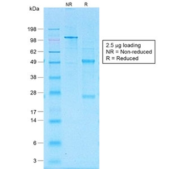 CD30 Antibody