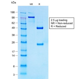 CD30 Antibody