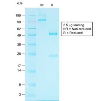 Glypican 3 Antibody / GPC3