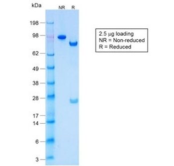 Acidic Cytokeratin Antibody