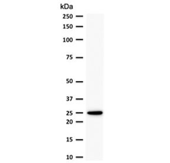 Bcl-2 Antibody