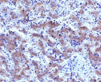 Glypican 3 Antibody / GPC3