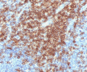 CD43 Antibody