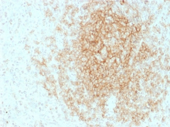 CD21 Antibody