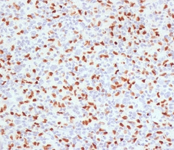 PU.1 Antibody / SPI1