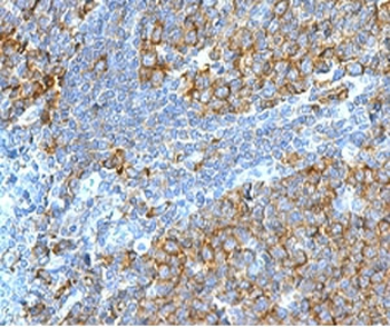 RPSA Antibody / 40S Ribosomal protein SA