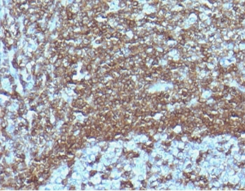 CD6 Antibody