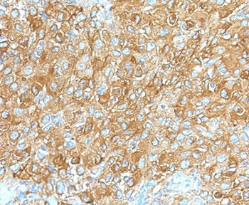 CD63 Antibody / LAMP-3