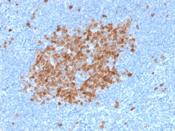 Thymidylate Synthase Antibody